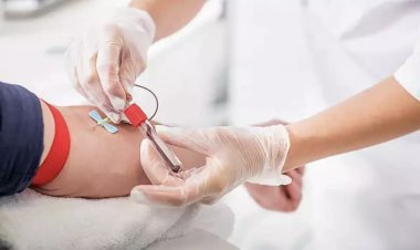 Now it is not necessary to give blood in exchange for blood, only processing fee will be charged, government made new rules for blood banks