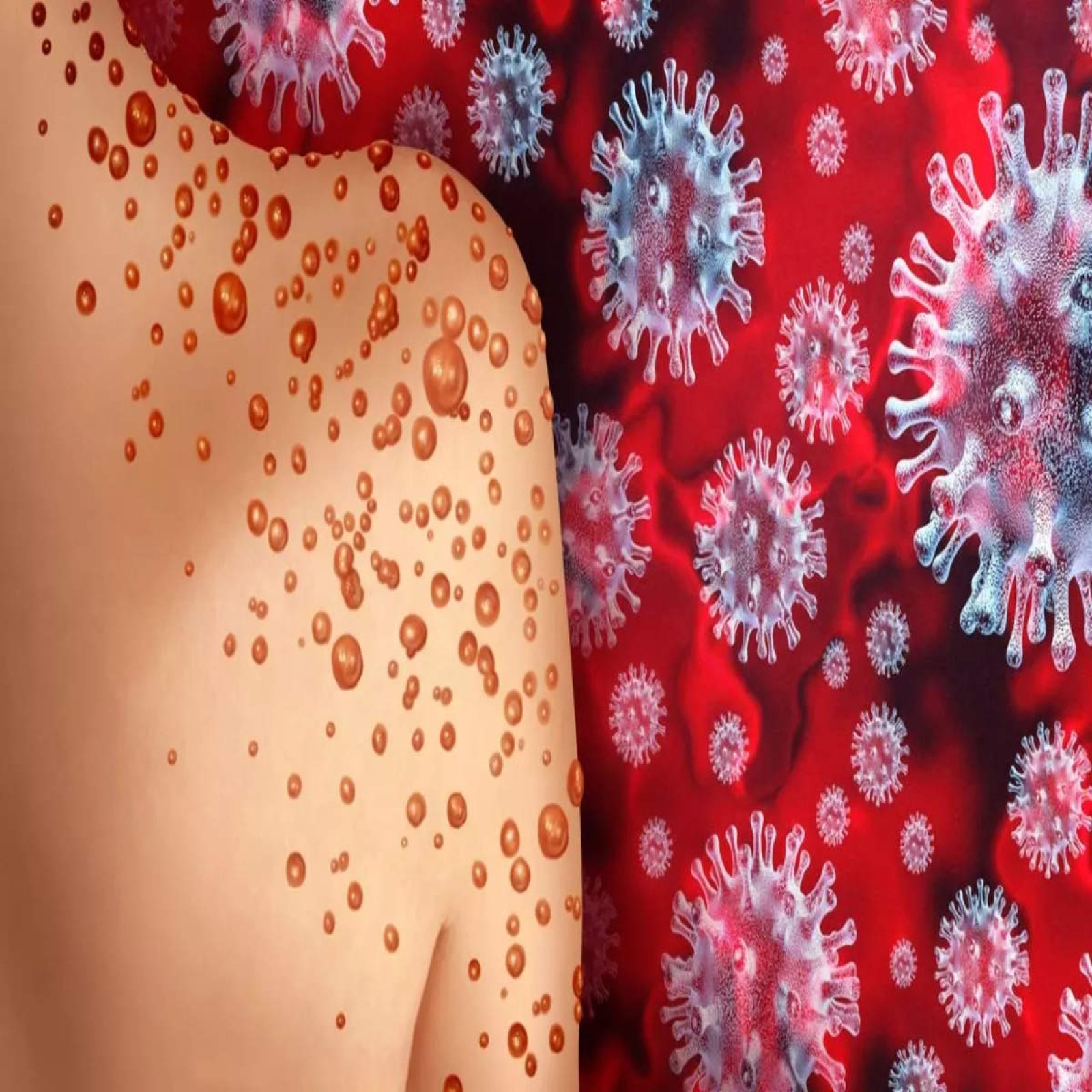 Mpox is scaring in Pakistan, now three new cases surfaced in Karachi; Government on high alert